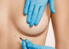 Aumento de pecho: opciones y decisiones informadas